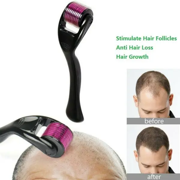 skin-therapy-derma-roller-with-540-micro-needle-roller-for-men-and-women-derma-roller-540-titanium-needle - 7 (1).webp